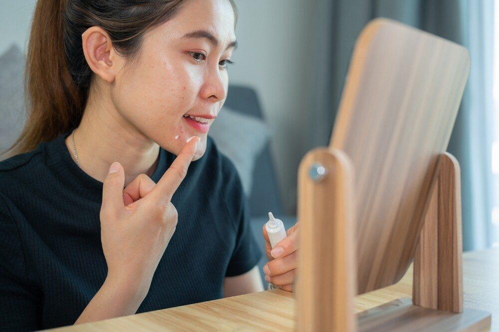 รักษาสิวประจำเดือน สิวฮอร์โมนให้หายแบบไม่ทำลายชั้นผิว