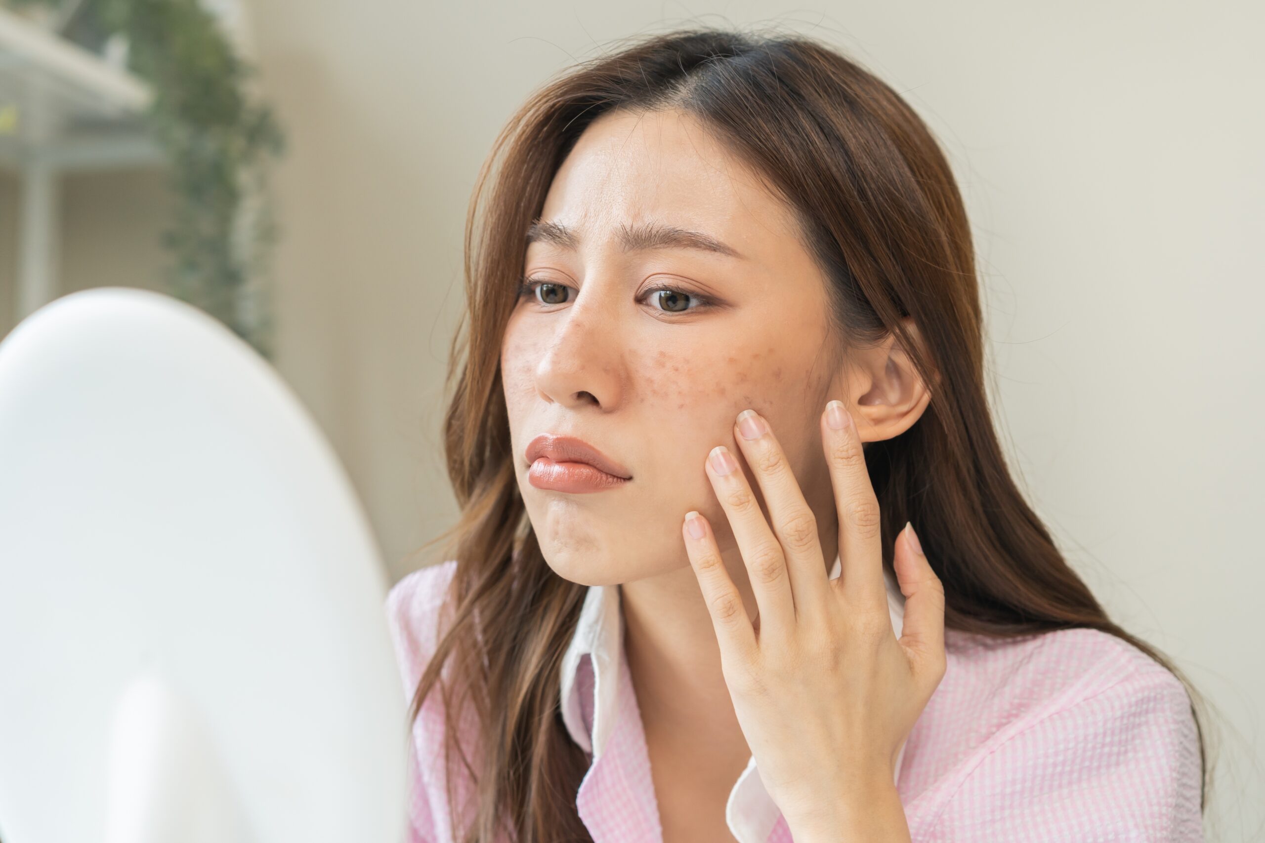 A woman considering laser freckle removal
