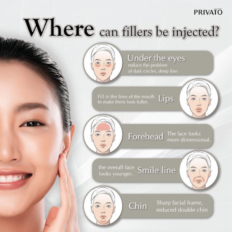 ฟิลเลอร์ฉีดตรงไหนได้บ้าง? 5 จุดบนใบหน้าที่นิยมฉีดฟิลเลอร์
