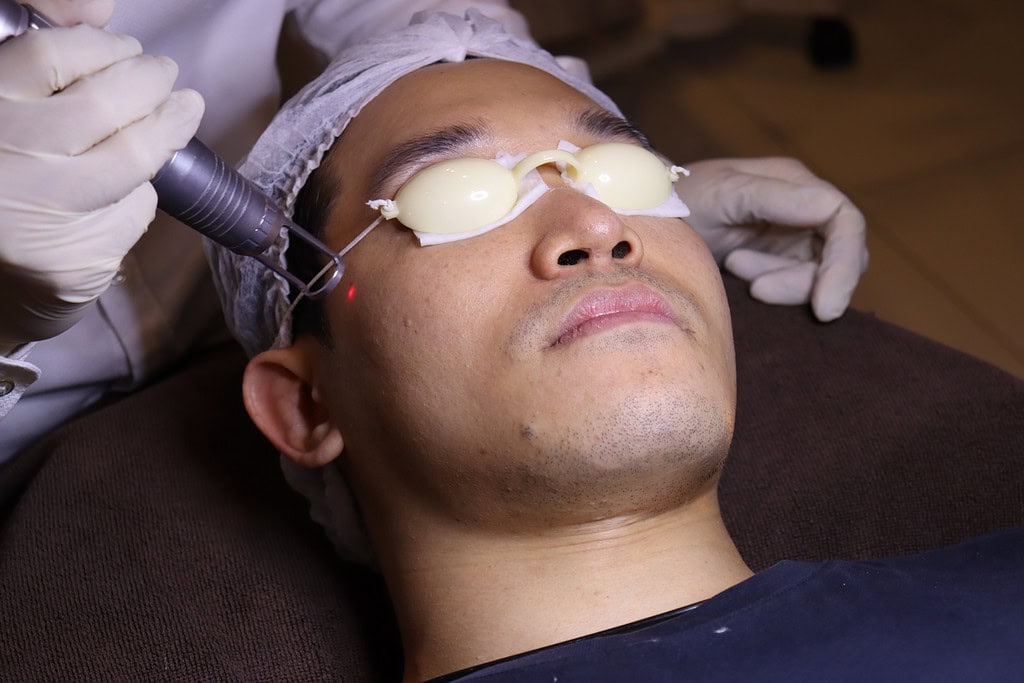 ลูกค้ากำลังเข้ารับบริการโปรแกรมเลเซอร์ผิวหน้า M-White Laser
