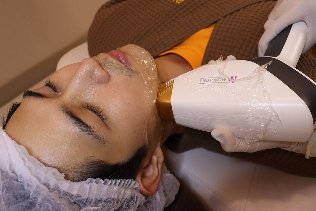 ลูกค้ากำลังเข้ารับบริการโปรแกรมเลเซอร์กำจัดขน 2M Laser Hair Removal(Close-up)