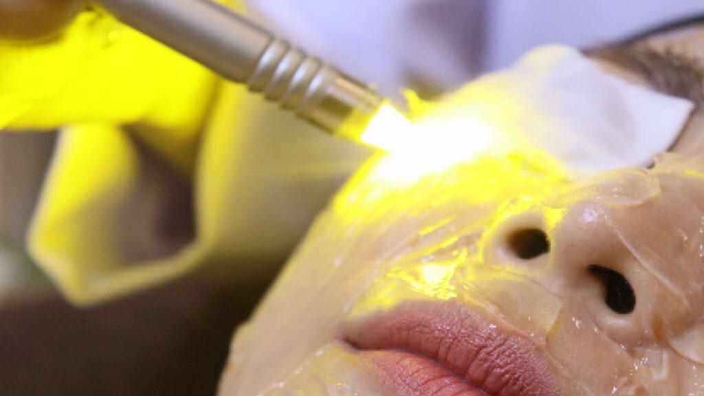 ลูกค้ากำลังเข้ารับบริการโปรแกรมเลเซอร์ผิวหน้า DY Shining Bright Laser (Extreme Close-up)