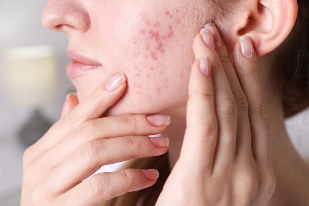 IPL กับ Pico Laser ต่างกันอย่างไร จะเลือกแบบไหนดี