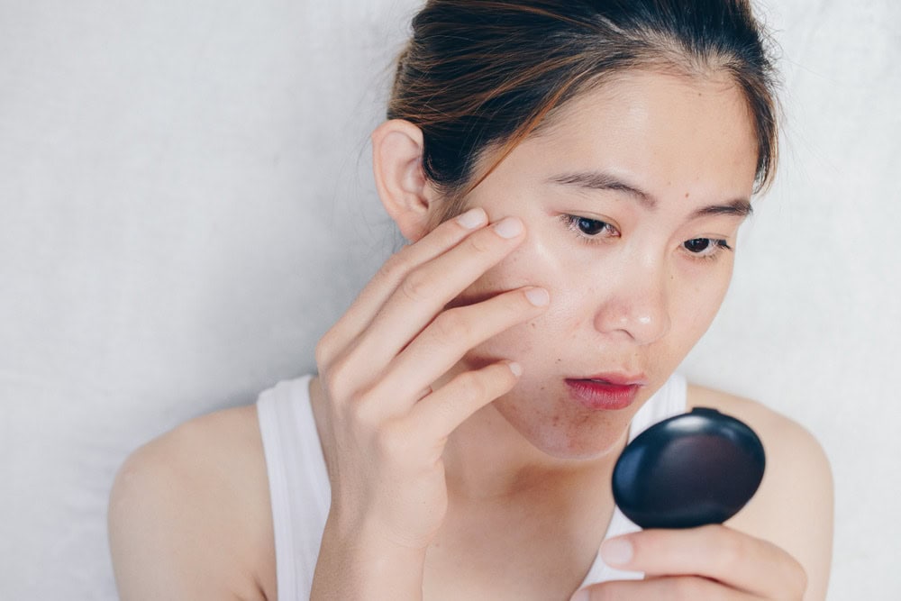 ผู้หญิงกังวลกับปัญหาผิว และสงสัยว่า Pico Laser มีกี่แบบ แบบไหนที่เหมาะกับตัว