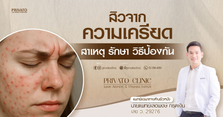 สิวจากความเครียด: สาเหตุ กลไก และวิธีจัดการ