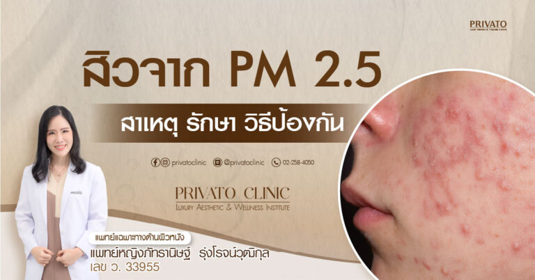สิวจาก PM 2.5: วิธีป้องกัน ดูแล และรักษา