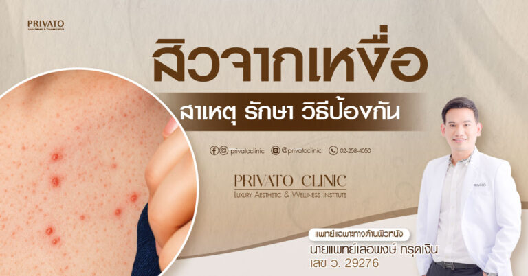วิธีจัดการสิวจากเหงื่อ (Acne Vulgaris) อย่างได้ผล