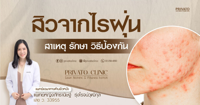 สิวจากไรฝุ่น: สาเหตุ การรักษา และการป้องกัน