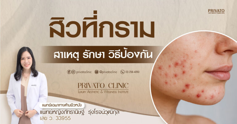 สิวที่กราม: สาเหตุ วิธีรักษา และการป้องกัน