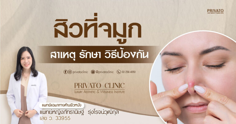 สิวที่จมูก: สาเหตุ วิธีรักษา และการป้องกันที่ถูกต้อง