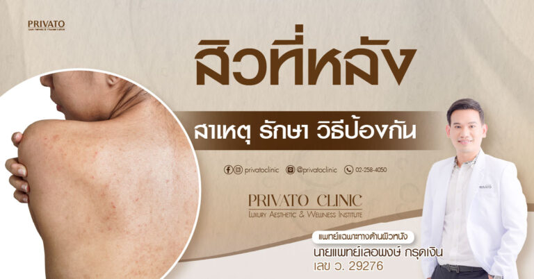 สิวที่หลัง: สาเหตุ การรักษา และการป้องกัน