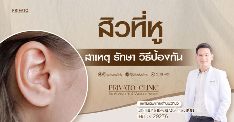 สิวที่หู: สาเหตุ วิธีรักษา และเรื่องที่ต้องรู้เกี่ยวกับสิวในหู
