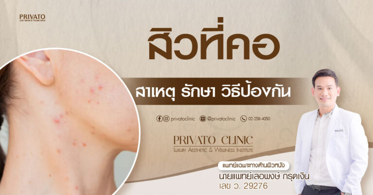 สิวที่คอ: สาเหตุ วิธีรักษา และการป้องกันที่ถูกวิธี