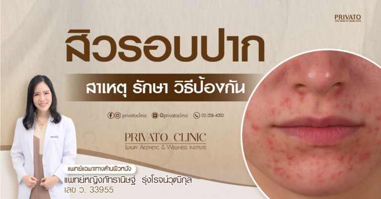 สิวรอบปาก: สาเหตุ วิธีรักษา และวิธีป้องกันที่ถูกต้อง