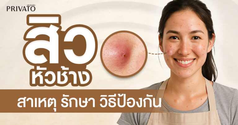 สิวหัวช้าง: สาเหตุ การรักษา และวิธีป้องกันที่ถูกต้อง