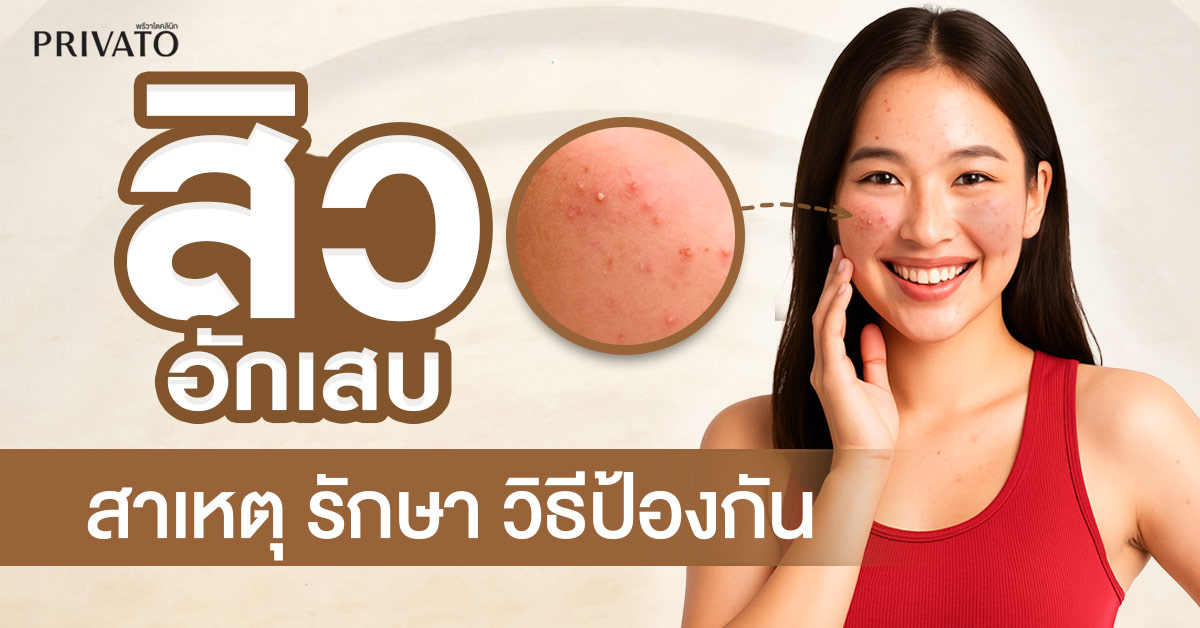 สิวอักเสบ: สาเหตุ วิธีรักษา และการป้องกันที่ถูกต้อง